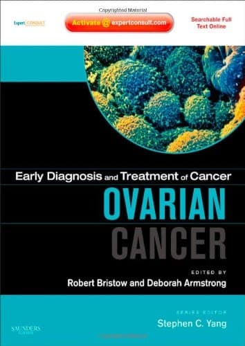 Ovarian Cancer