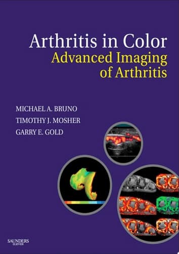 Arthritis in Color Advanced Imaging of Arthritis