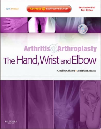 Arthritis and Arthroplasty The hand, wrist and elbow