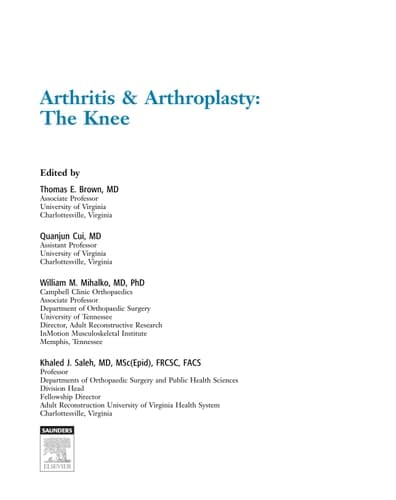 Arthritis & Arthroplasty The knee