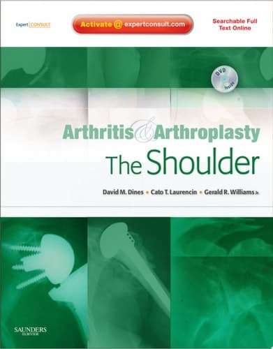 Arthritis and Arthroplasty The shoulder