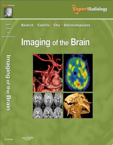 Imaging of the Brain Expert Radiology Series
