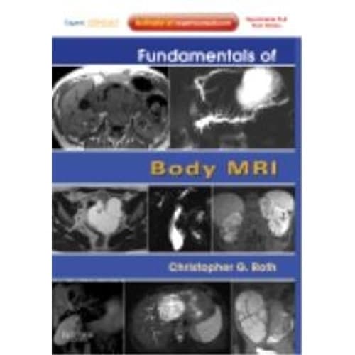 Fundamentals of Body MRI