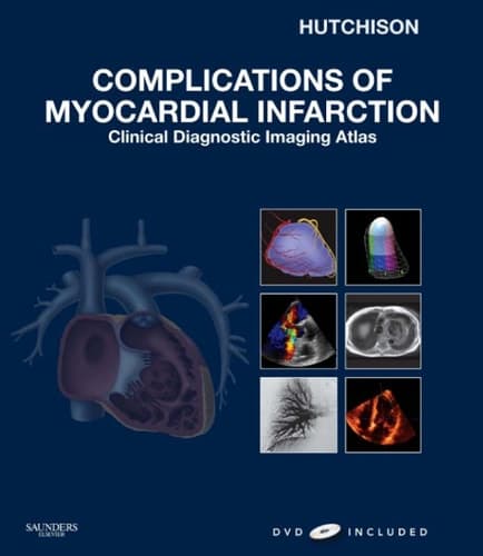 Complications of Myocardial Infarction Clinical Diagnostic Imaging Atlas