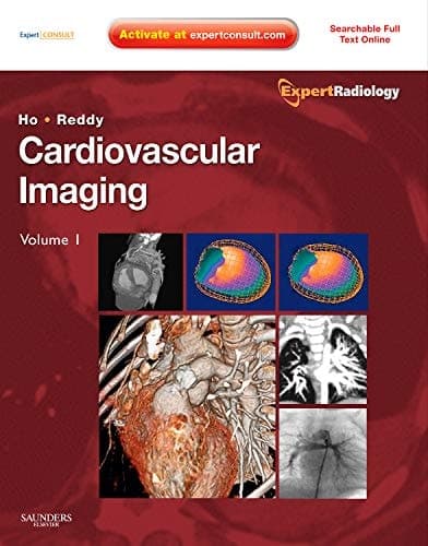 Cardiovascular Imaging: Vascular imaging