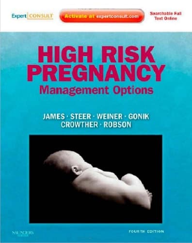 High Risk Pregnancy Management Options