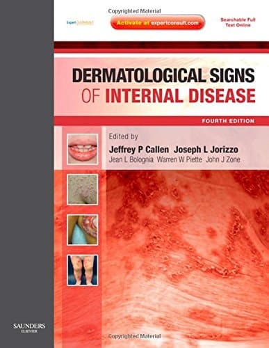 Dermatological Signs of Internal Disease: Expert Consult - Online and Print