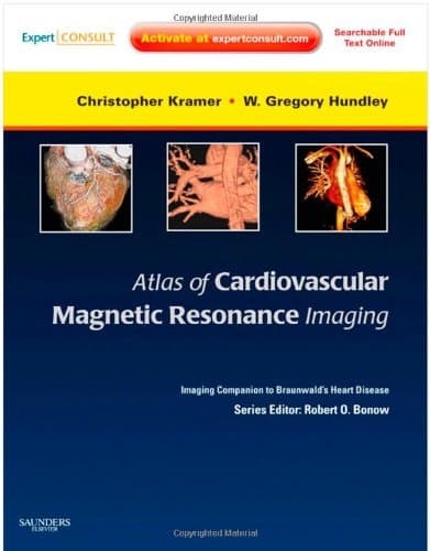 Atlas of Cardiovascular Magnetic Resonance Imaging An Imaging Companion to Braunwald's Heart Disease