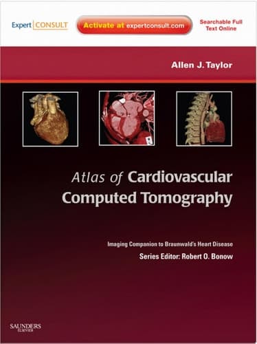 Atlas of Cardiovascular Computed Tomography An Imaging Companion to Braunwald's Heart Disease