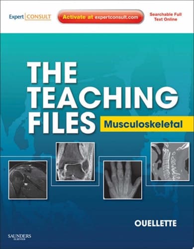 The Teaching Files Musculoskeletal
