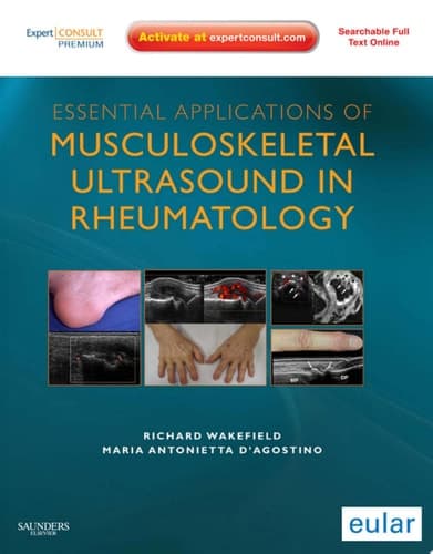 Essential Applications of Musculoskeletal Ultrasound in Rheumatology Expert Consult Premium Edition: Enhanced Online Features and Print
