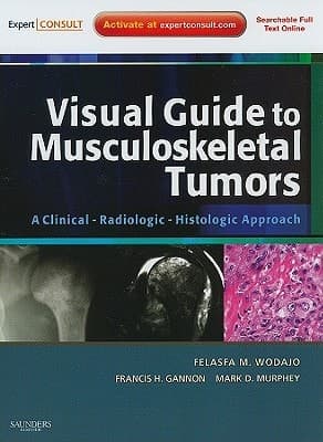 Visual Guide to Musculoskeletal Tumors A Clinical, Radiologic, Histologic Approach