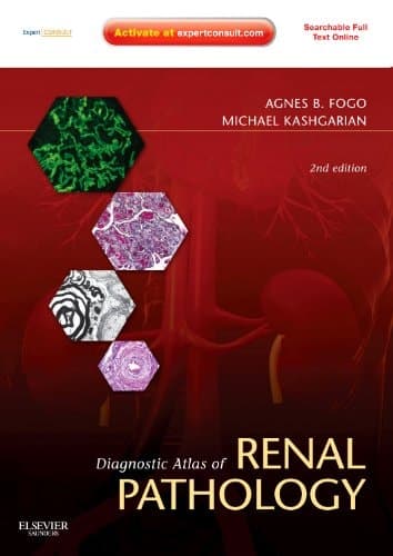 Diagnostic Atlas of Renal Pathology A Companion to Brenner & Rector's the Kidney