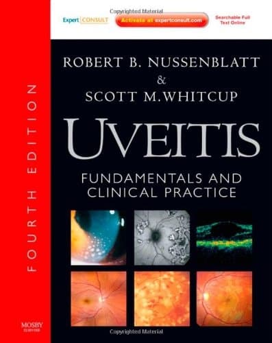 Uveitis Fundamentals and Clinical Practice