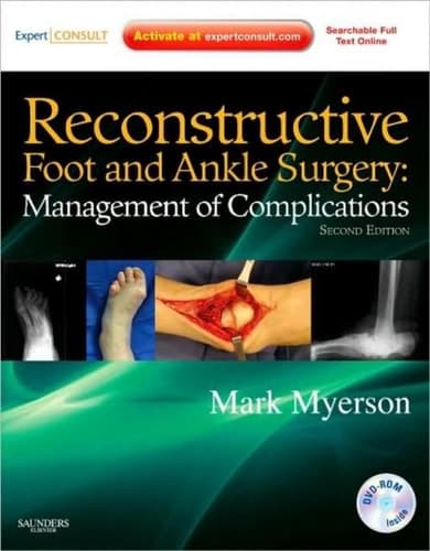 Reconstructive Foot and Ankle Surgery Management of Complications