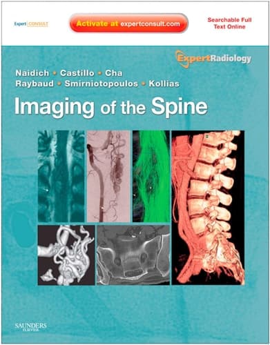 Imaging of the Spine Expert Radiology Series, Expert Consult-Online and Print