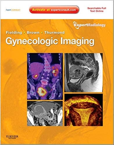 Gynecologic Imaging