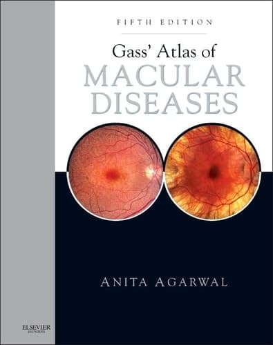 Gass' Atlas of Macular Diseases 2-Volume Set - Expert Consult: Online and Print