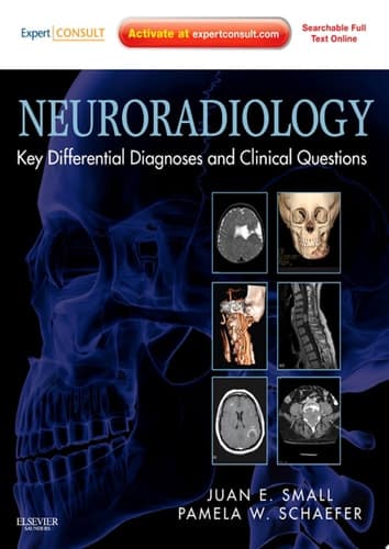 Neuroradiology: Key Differential Diagnoses and Clinical Questions Expert Consult - Online and Print