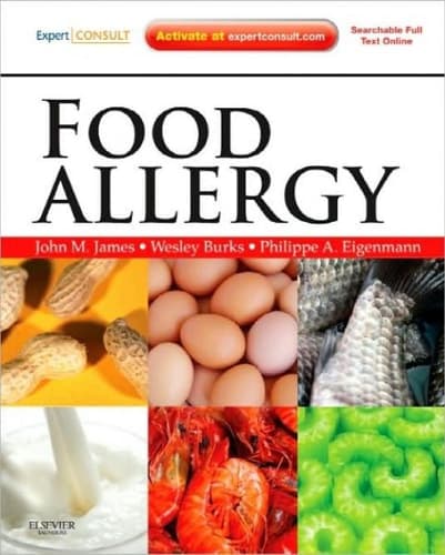 Food Allergy Expert Consult Basic