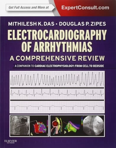 Electrocardiography of Arrhythmias: A Comprehensive Review A Companion to Cardiac Electrophysiology