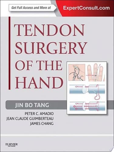 Tendon Surgery of the Hand Expert Consult - Online and Print
