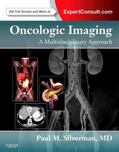 Oncologic Imaging A Multidisciplinary Approach