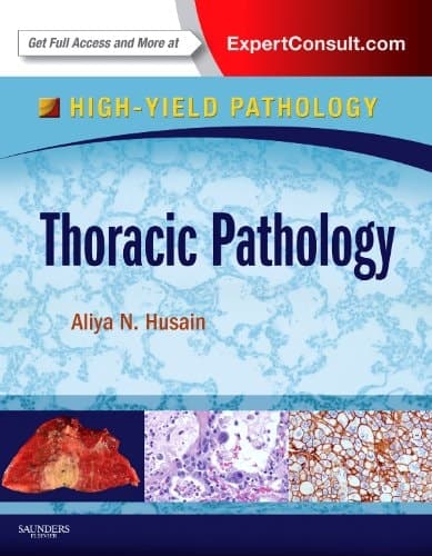 Thoracic Pathology A Volume in the High Yield Pathology Series (Expert Consult - Online and Print)