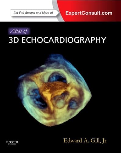 Atlas of 3D Echocardiography Expert Consult - Online and Print