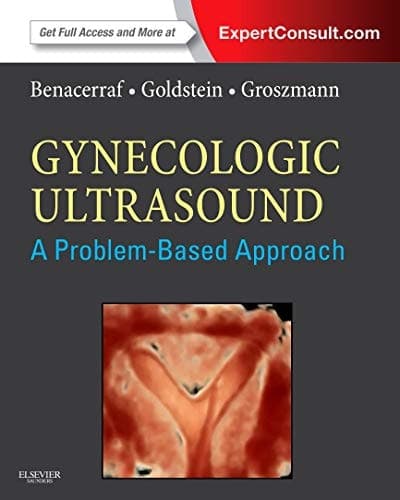 Gynecologic Ultrasound A Problem-based Approach