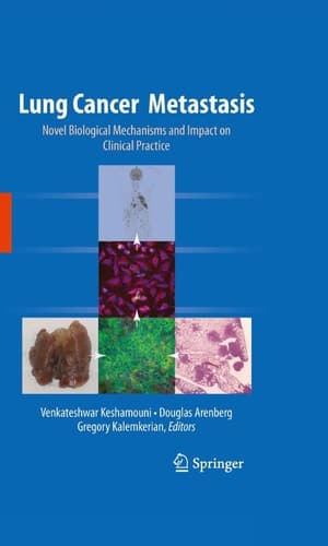 Lung Cancer Metastasis Novel Biological Mechanisms and Impact on Clinical Practice
