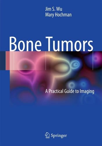 Bone Tumors A Practical Guide to Imaging