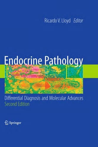 Endocrine Pathology: Differential Diagnosis and Molecular Advances