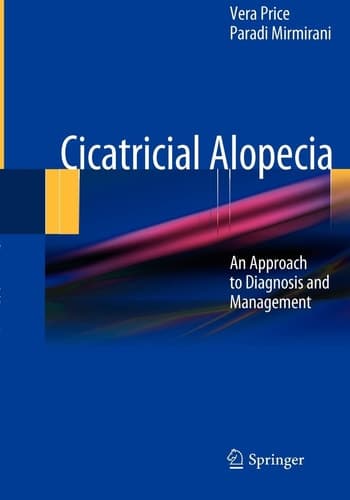 Cicatricial Alopecia An Approach to Diagnosis and Management