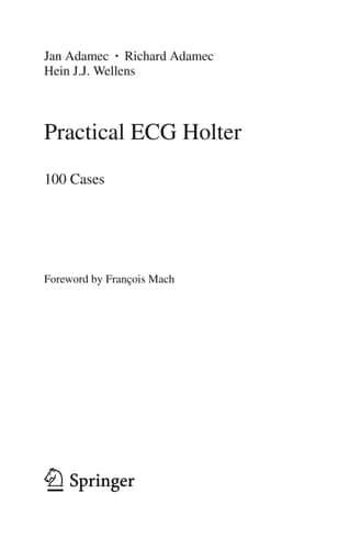 Practical ECG Holter 100 Cases