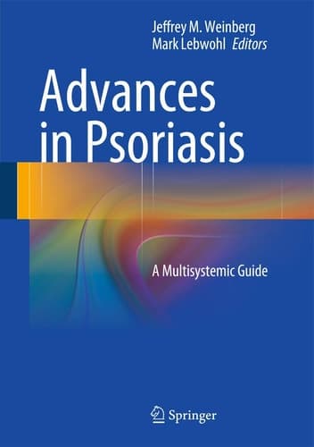 Advances in Psoriasis A Multisystemic Guide