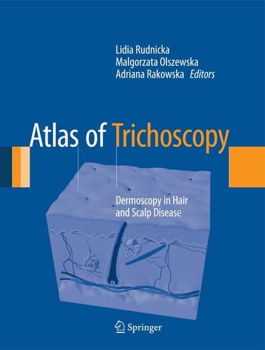 Atlas of Trichoscopy Dermoscopy in Hair and Scalp Disease