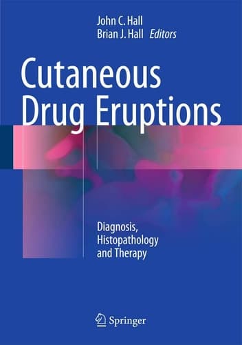 Cutaneous Drug Eruptions Diagnosis, Histopathology and Therapy