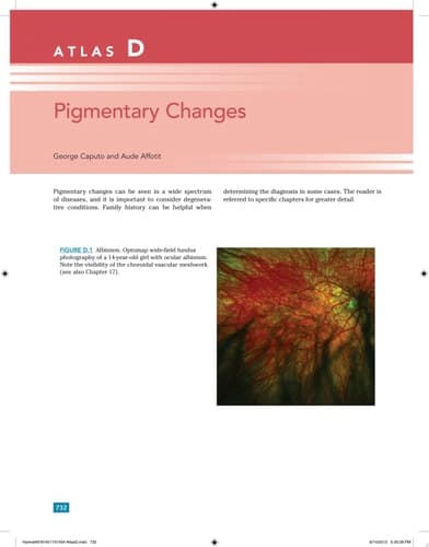Pediatric Retina