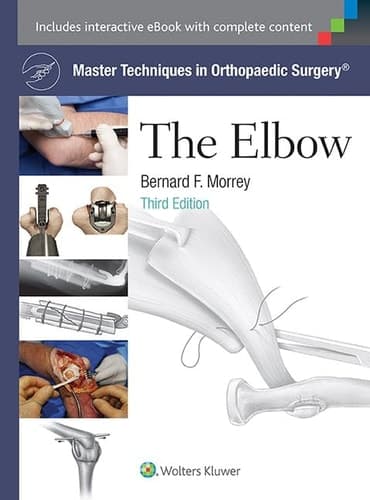 The Elbow