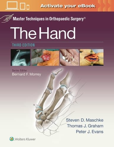The Hand