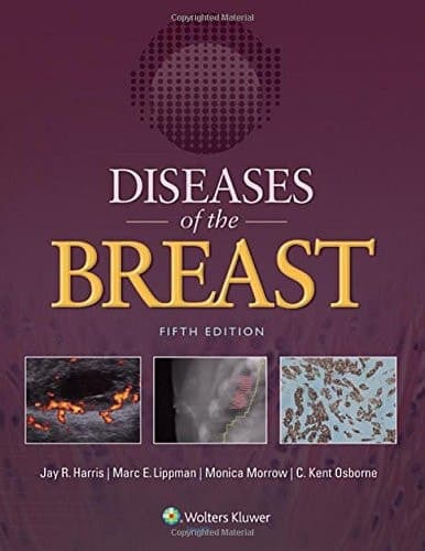 Diseases of the Breast