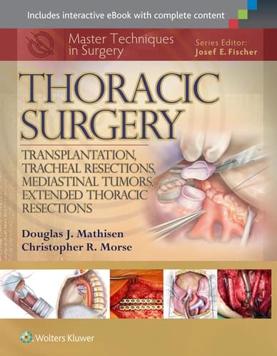 Thoracic Surgery Transplantation, tracheal resections, mediastinal tumors, extended thoracic resections