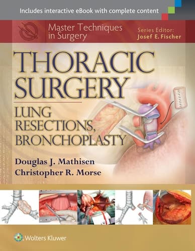 Thoracic Surgery Lung resections, bronchoplasty