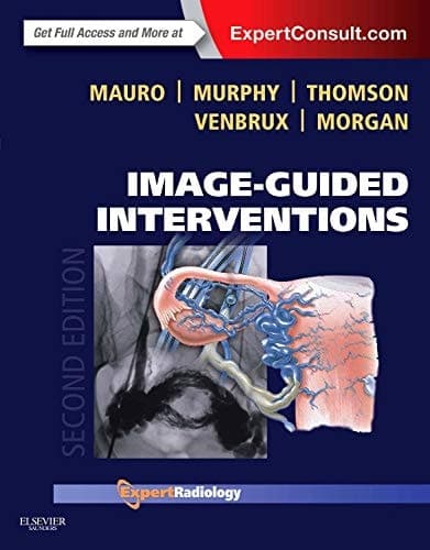 Image-guided Interventions