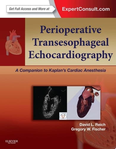Perioperative Transesophageal Echocardiography A Companion to Kaplan's Cardiac Anesthesia (Expert Consult: Online and Print)