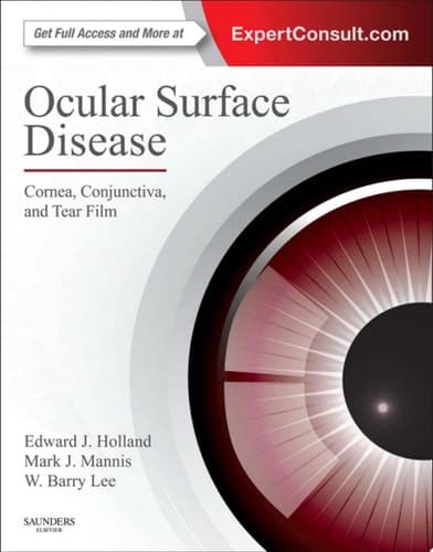 Ocular Surface Disease: Cornea, Conjunctiva and Tear Film Expert Consult - Online and Print