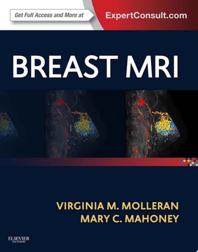 Breast MRI Expert Consult: Online and Print