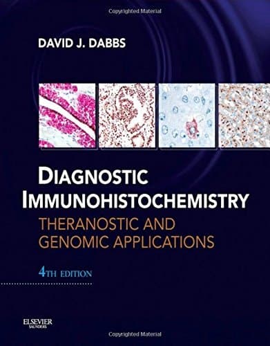 Diagnostic Immunohistochemistry Theranostic and Genomic Applications