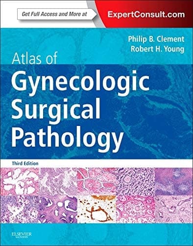 Atlas of Gynecologic Surgical Pathology